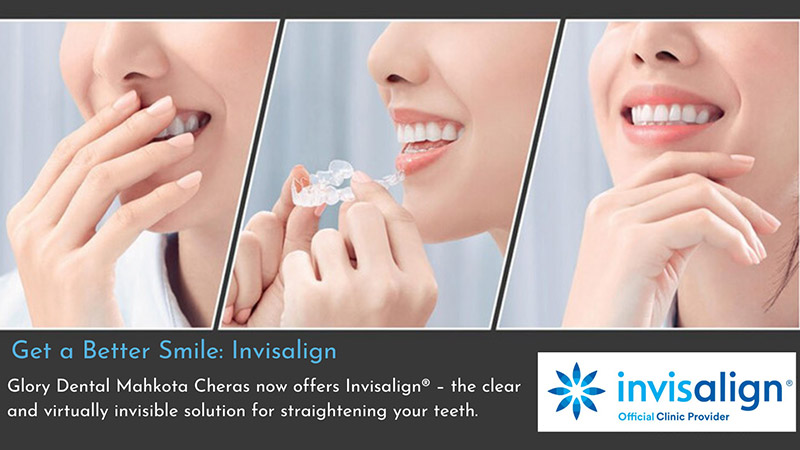 Get a better smile with Invisalign