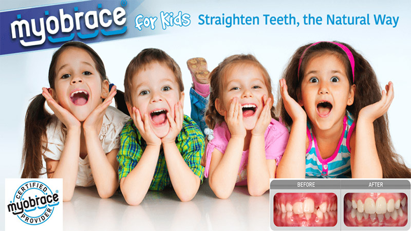 myobrace for kids, straighten teeth the natural way